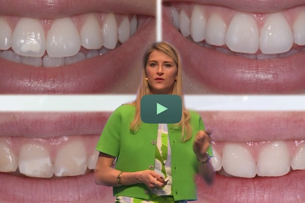 Traitement des MIH en antérieur